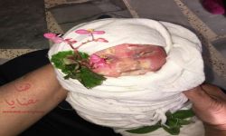 وفاة جنين في بلدة مضايا المحاصرة