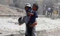 حالات سوء تغذية وأمراض جلدية بين أطفال حلب النازحين