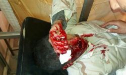 نجاة الشيخ محمد الجلم قاضي الجنايات بمحكمة دار العدل في حوران من محاولة اغتيال